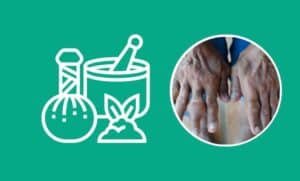 Ayurvedic Treatment for Gouty Arthritis