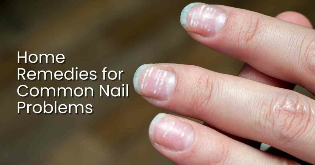 Home remedies and Natural tips for nail problems and nail care
