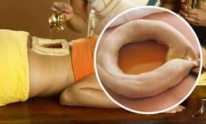 Kati Vasthi -the best back pain treatment in Kerala