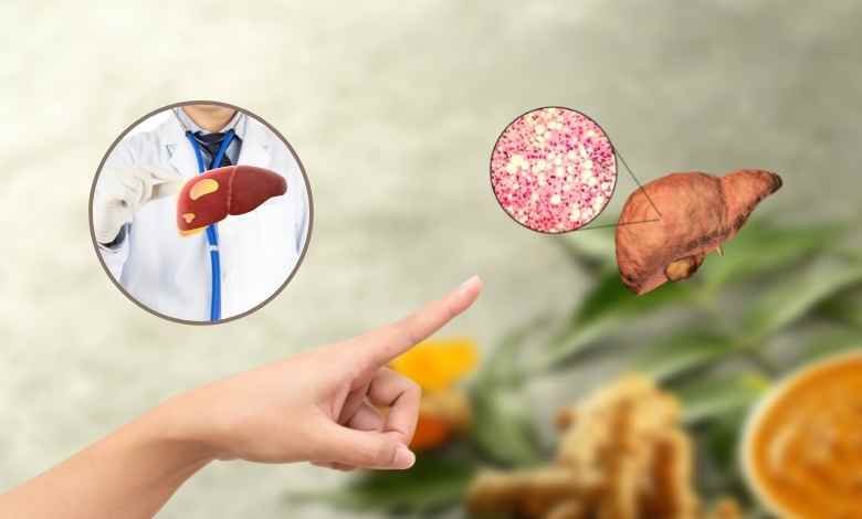 Ayurvedic Treatment For Fatty Liver