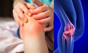 Ayurvedic Treatment for Juvenile Arthritis