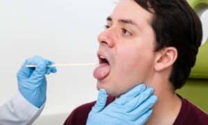 Ayurvedic Tongue Diagnosis