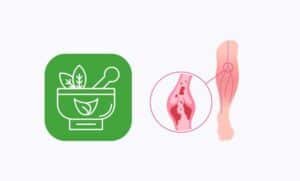 Ayurvedic Treatment for Varicose Vein