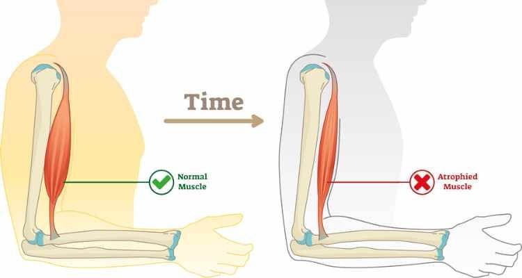 Ayurvedic Treatment for Muscular Dystrophy in Kerala