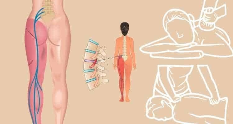 Ayurvedic Treatment for Sciatica in Kerala Ayurvedic Treatment for Sciatica in Kerala